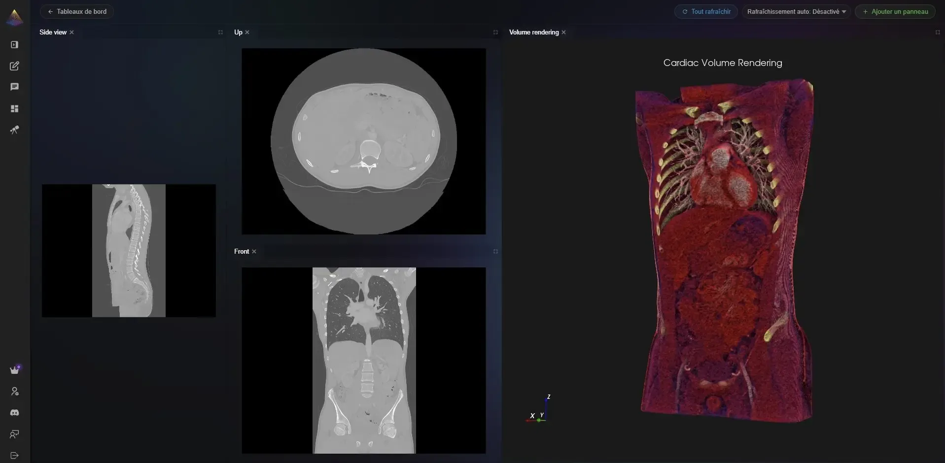 NVEIL 3D medical imaging visualization — CT scan volumetric data rendered in the browser, no code required